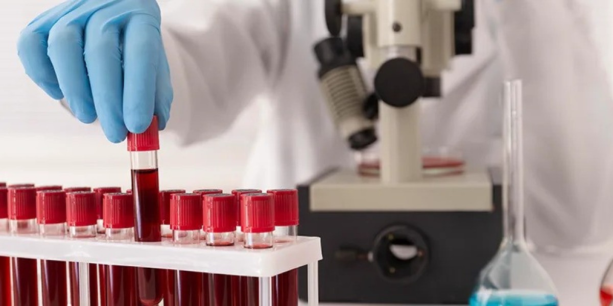 Why Young Adults Are Prioritizing Iron Health in 2026