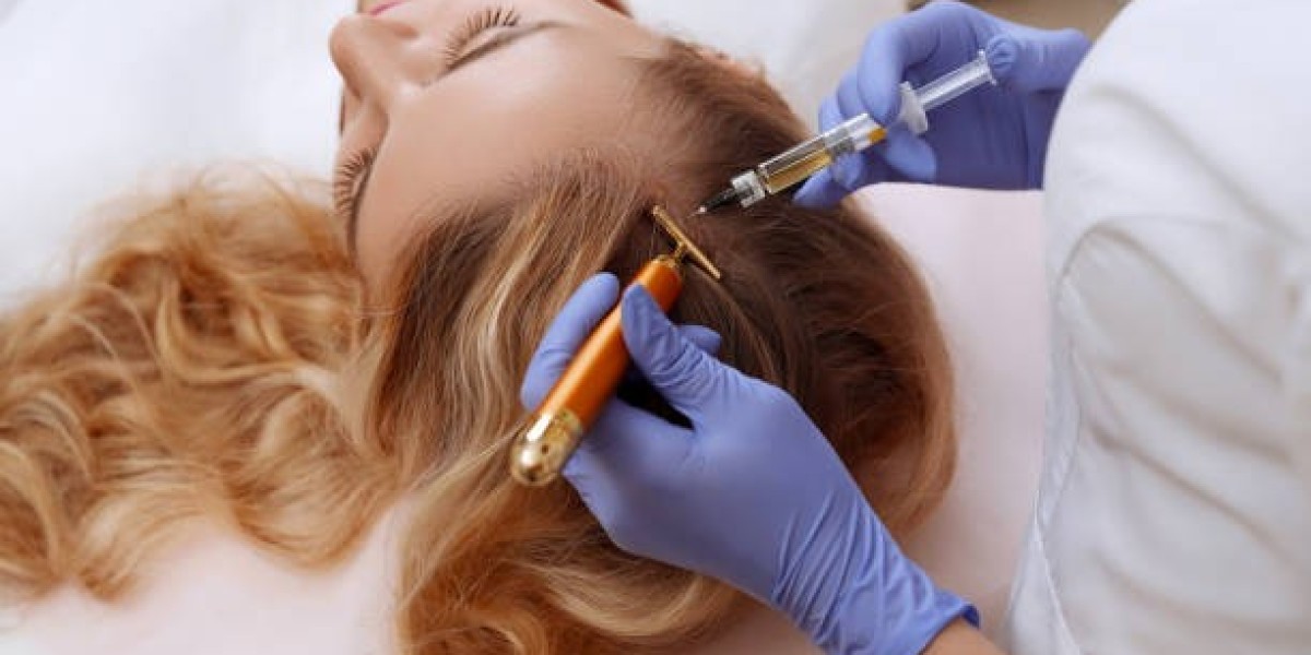 PRP Hair Treatment Before and After Results in Riyadh