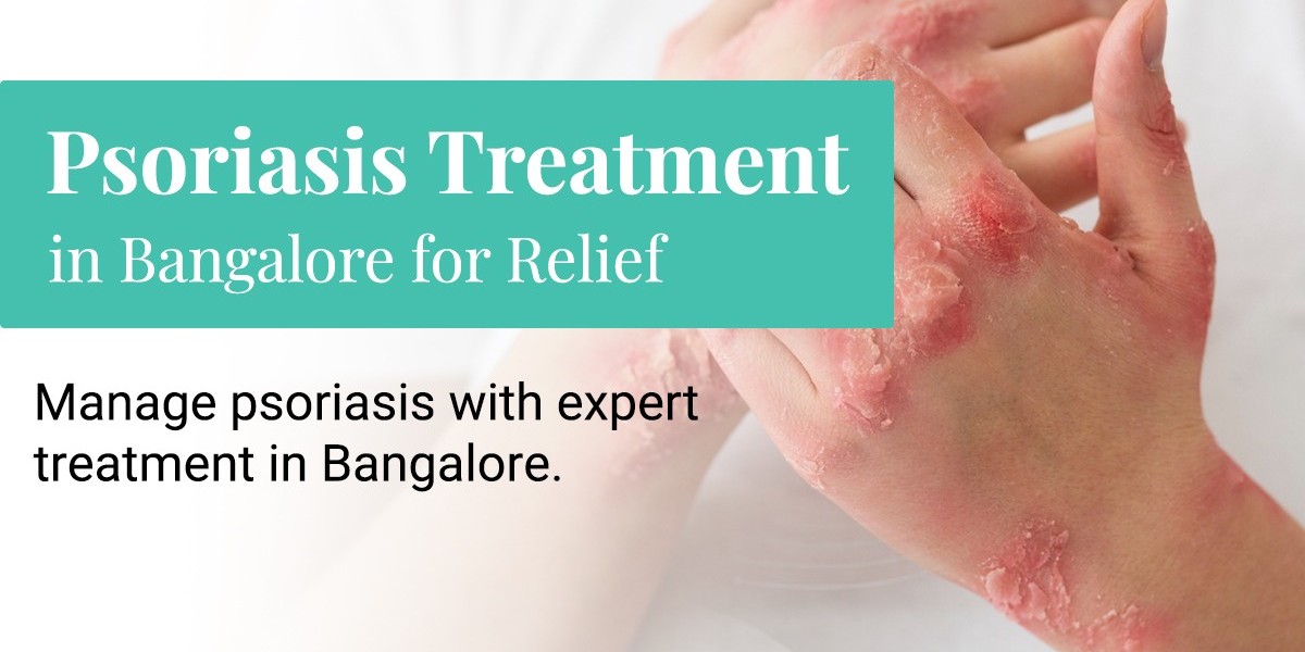 Why Psoriasis Needs a Long-Term Treatment Strategy