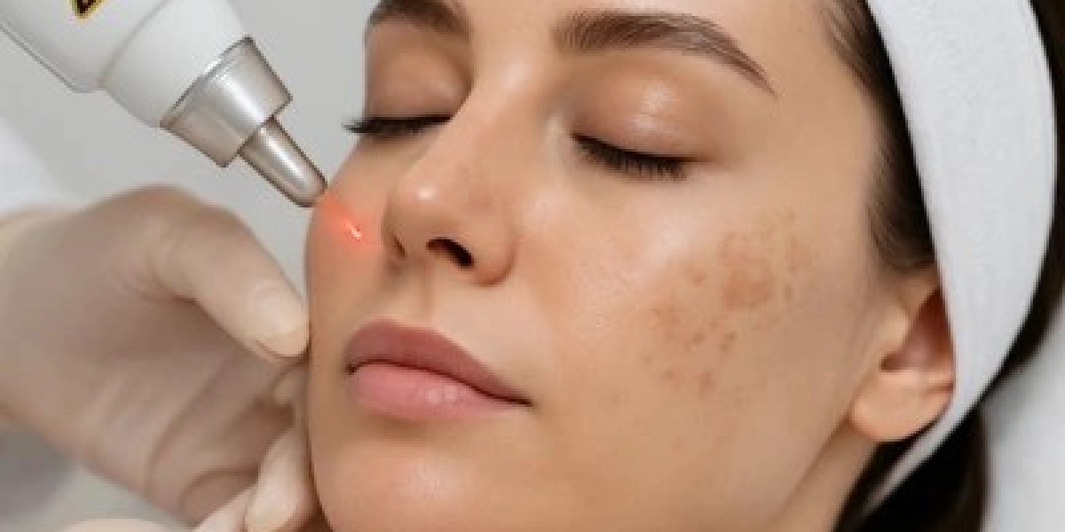 Pigmentation Treatment in Dubai: Improve Skin Tone, Reduce Visible Pigmentation