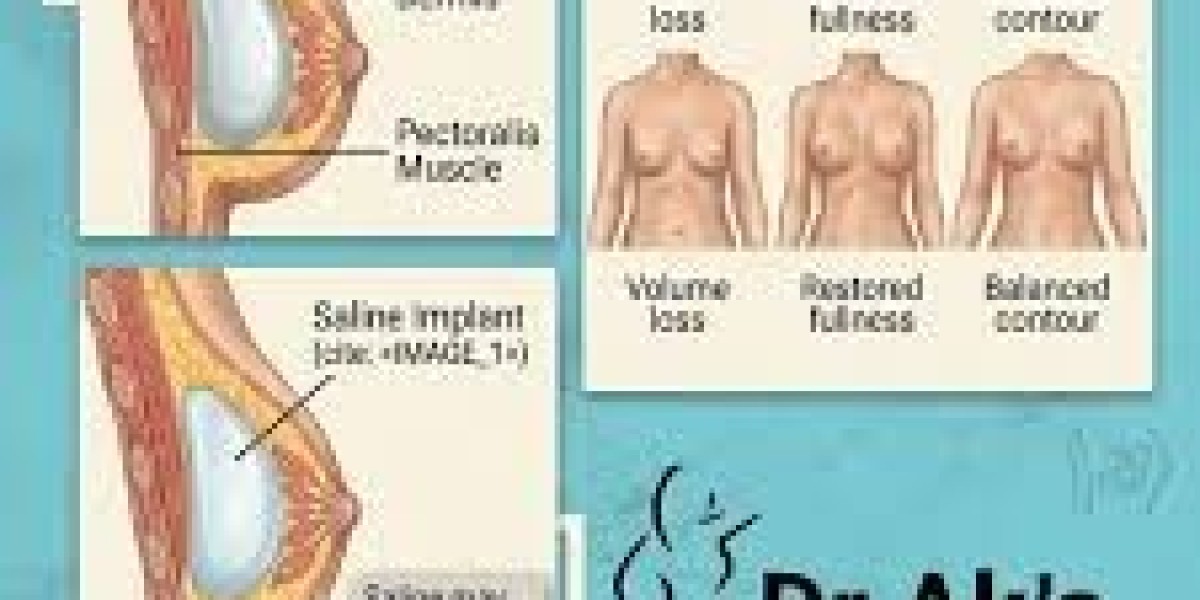 What Are the Benefits of Breast Augmentation in Islamabad?