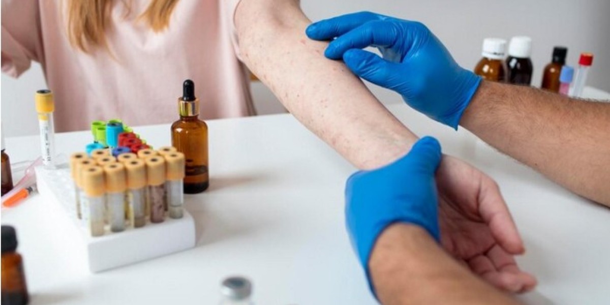 Clinical Insights Into Homoeopathic Care for Autoimmune Vitiligo