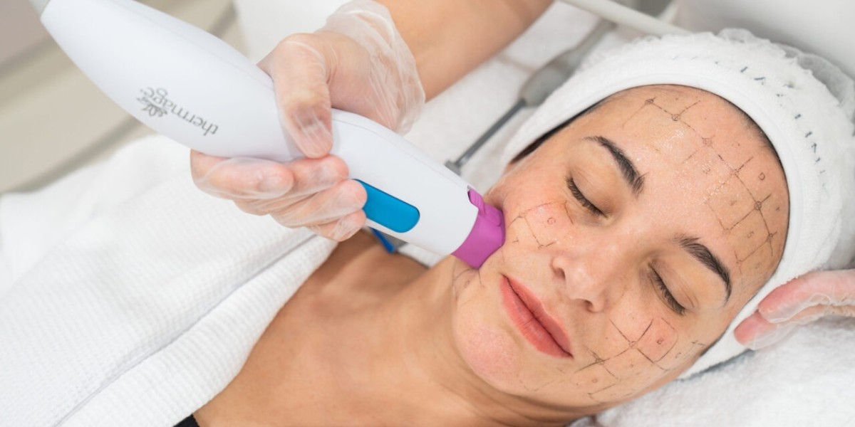 Why Personalized Thermage Skin Tightening in Dubai Matters