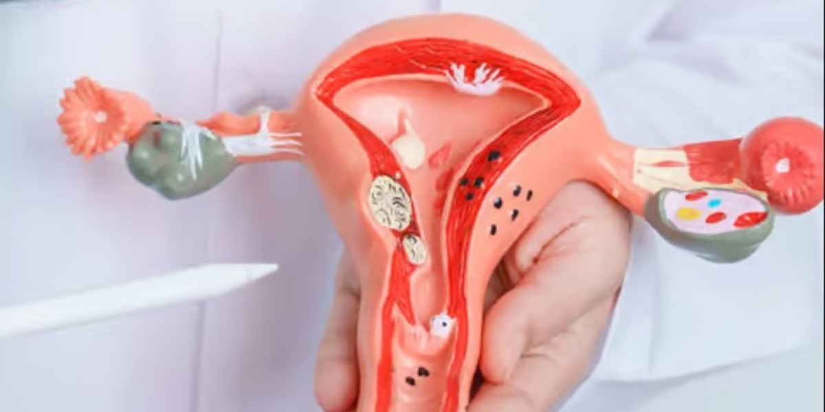 Menopause Treatment In Dubai: Personalized Solutions for Changing Hormonal Needs