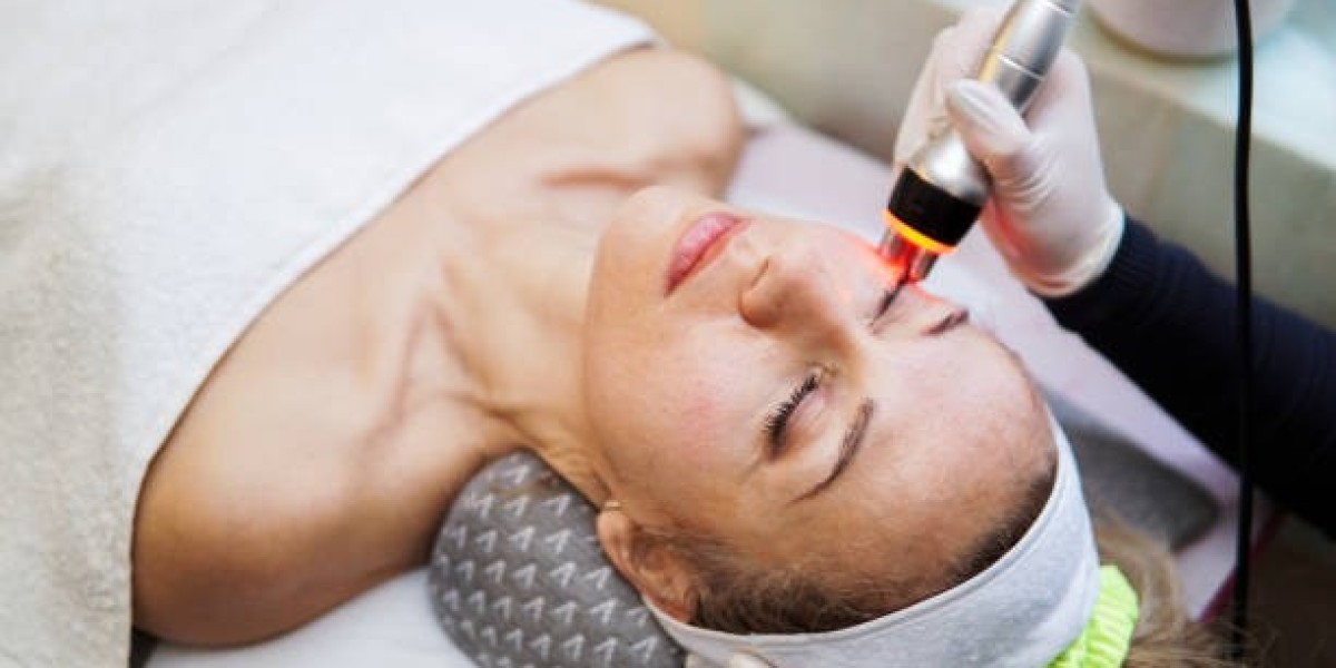 Fractional Laser vs. IPL: Which Treatment Is Right for You?