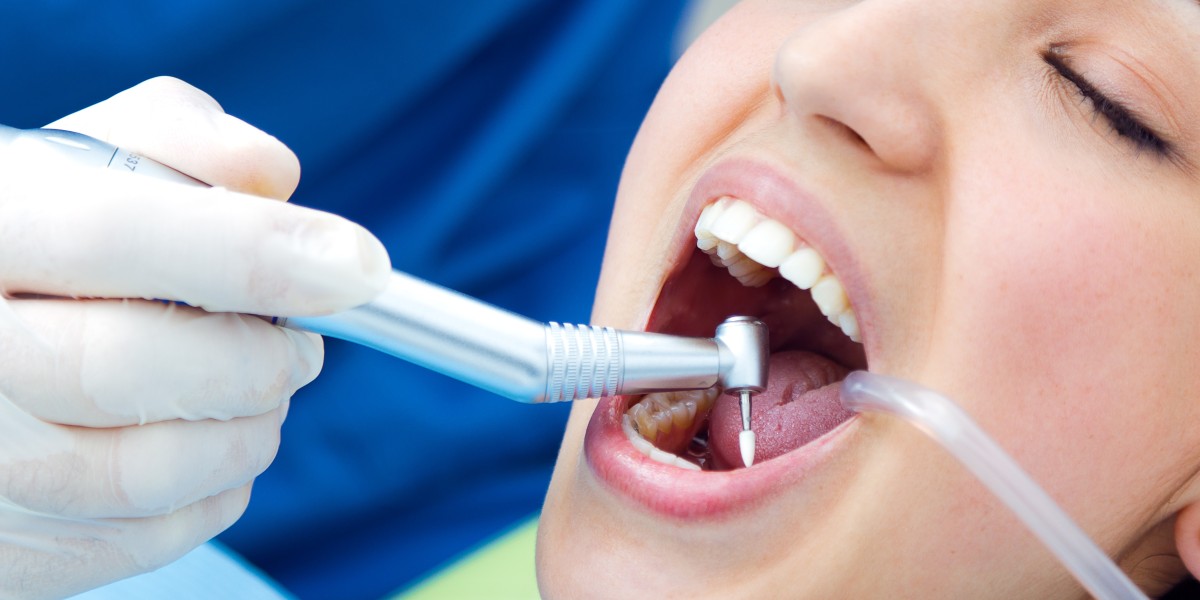 Tooth Extraction or Root Canal? How to Know Which Treatment May Save Your Tooth